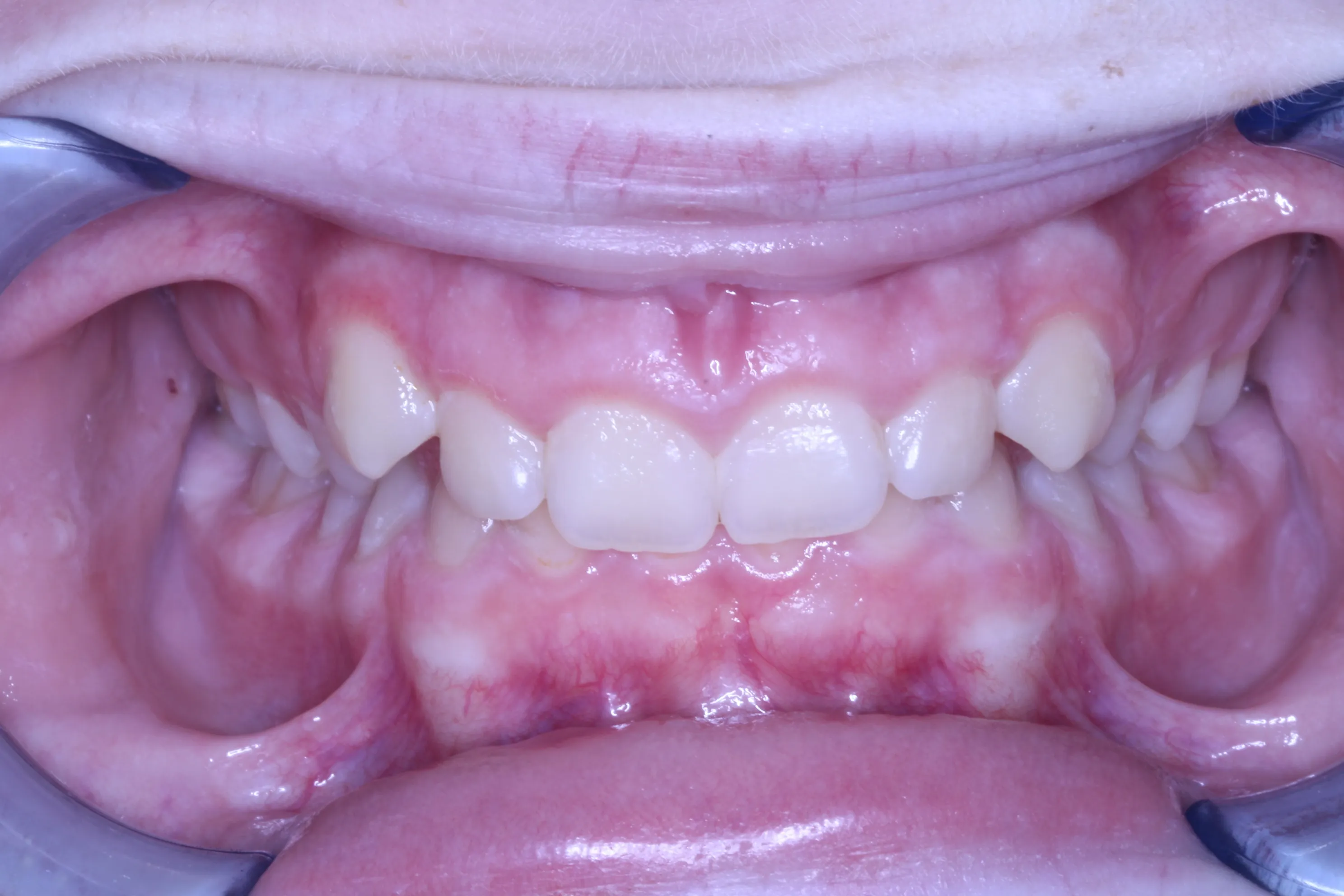 smile-gallery gallery